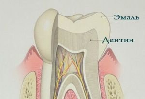 Восстановление эмали зубов